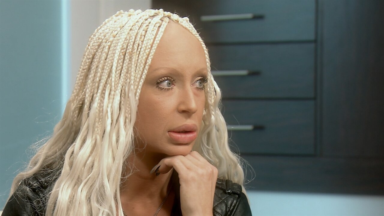 botched botched