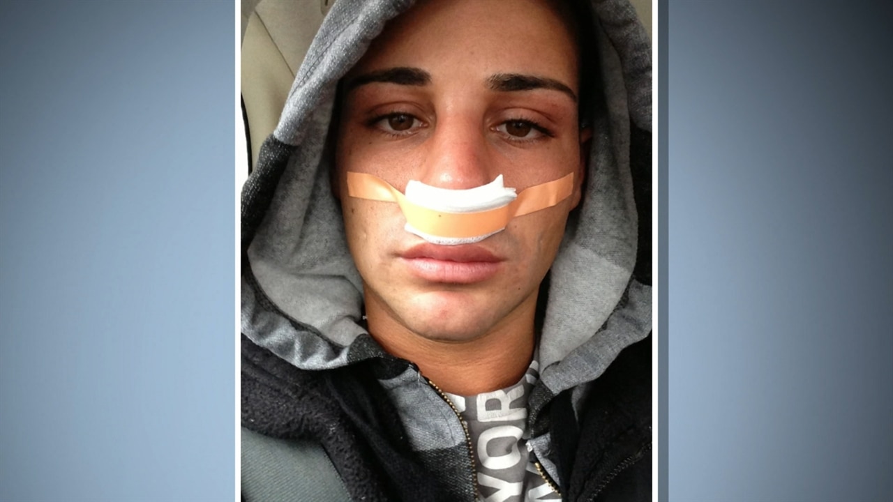 Botched BodyModifier Guy Wants a New Nose E! News