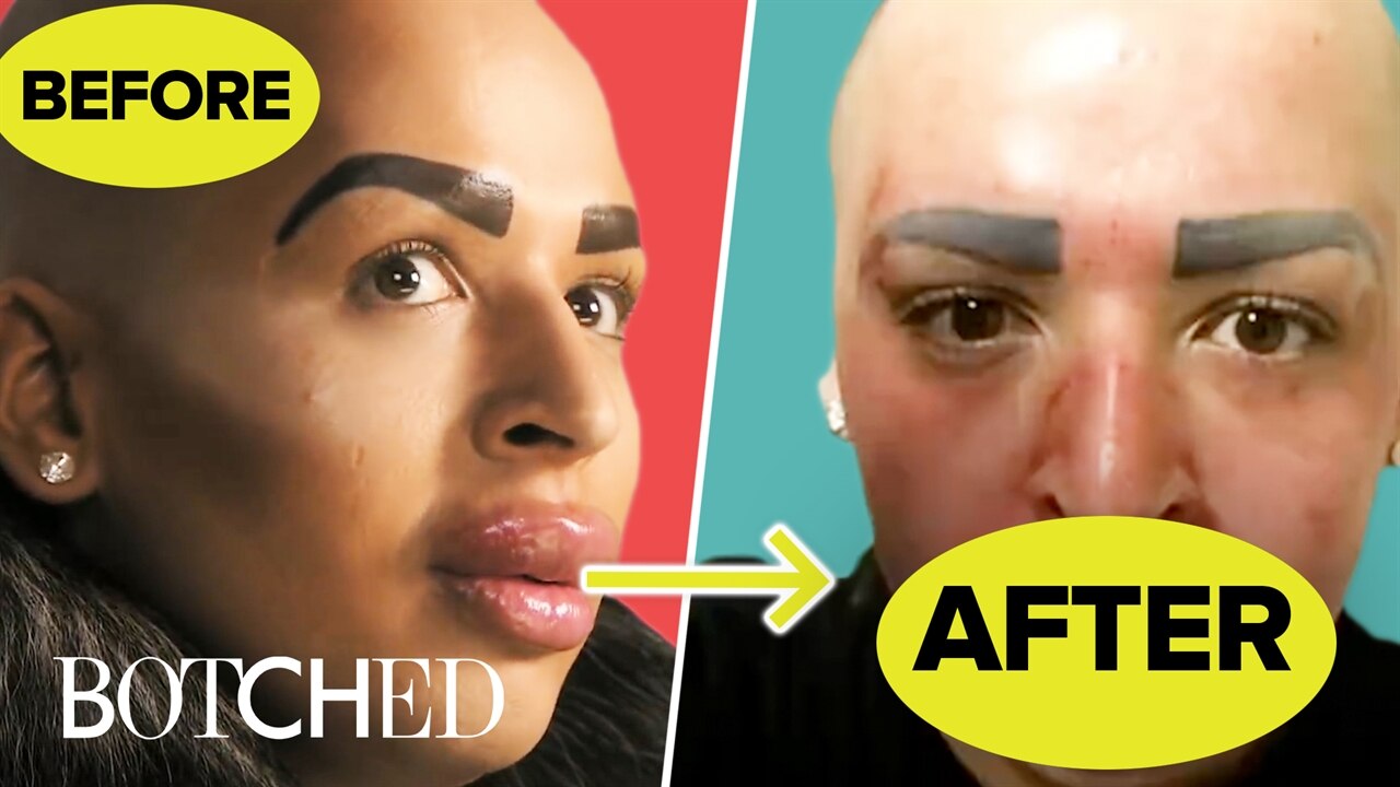 The Most Insane Lips On Botched On Botched E News Canada
