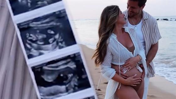 ‘Bachelorette's JoJo Fletcher Pregnant, Expecting Baby With Jordan Rodgers