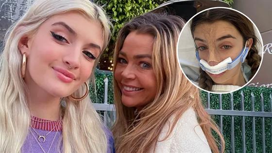 Charlie Sheen’s Daughter Sami Shares New Plastic Surgery Procedure Results(05)
