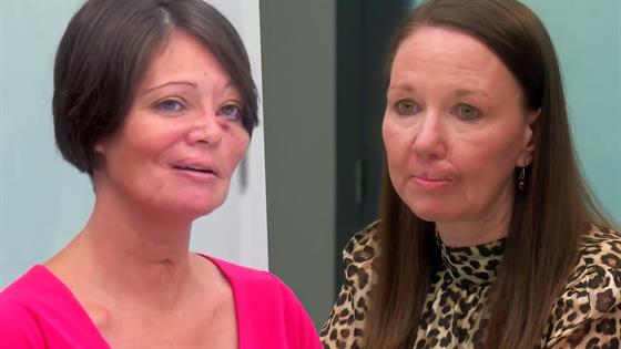 12 Minutes of UNBELIEVABLE Botched Transformations