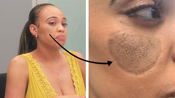 Dog Bite Victim Has Pubic Hair Growing On Her Face - E Online