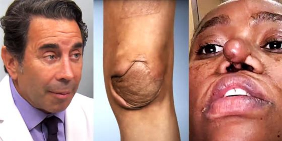 "Botched" Returns With Weird Knee & Nose Cases - E! Online.jpg