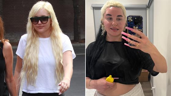 Amanda Bynes Opens Up About Weight Gain Due to Depression