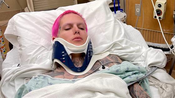 Jeffree Star Is Hospitalized After Suffering Injuries In Car Accident E Online Deutschland