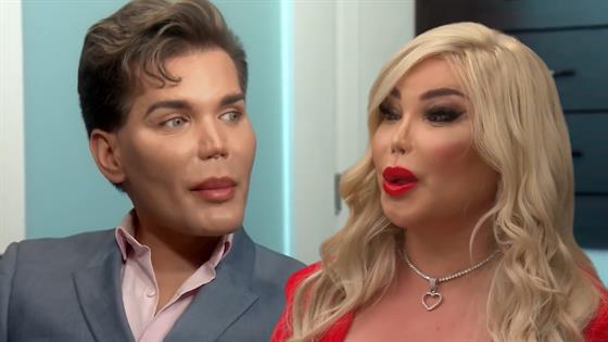 Amazing Transitions on Botched Rodrigo Alves